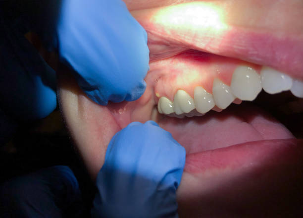 Best Emergency Dental Care for Trauma or Injury in Grandview, IL